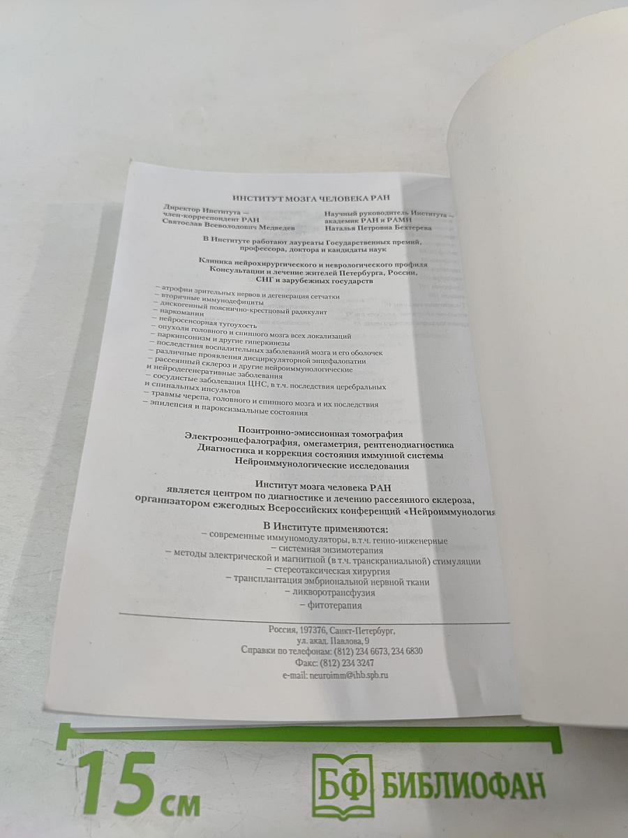 Рассеянный склероз