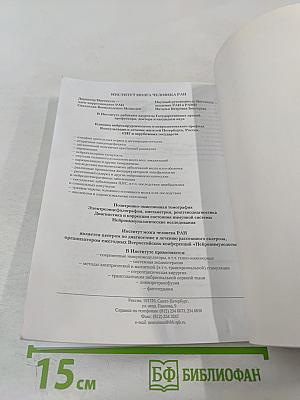Рассеянный склероз