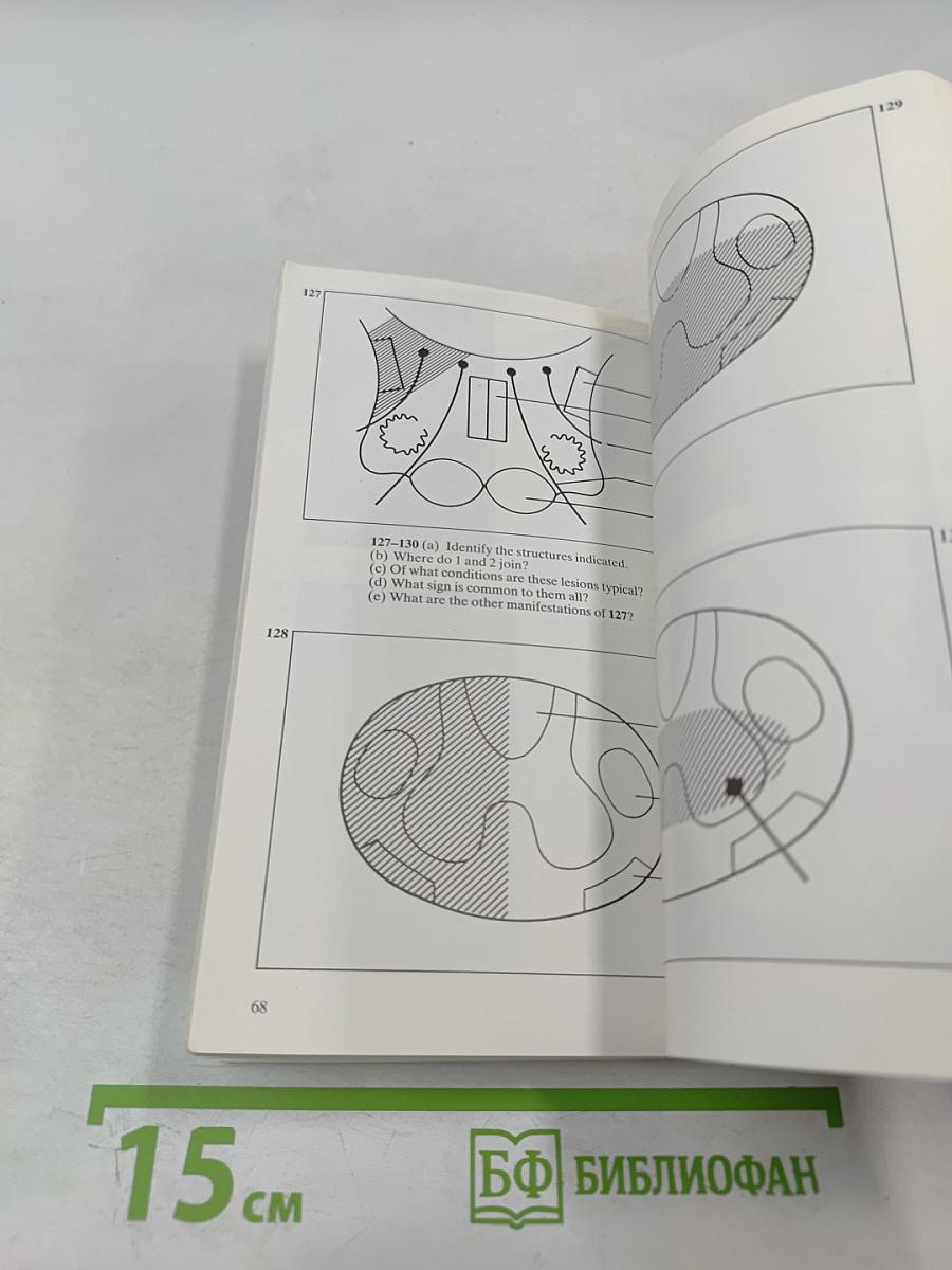 Diagnostic Picture Tests in Clinical Neurology