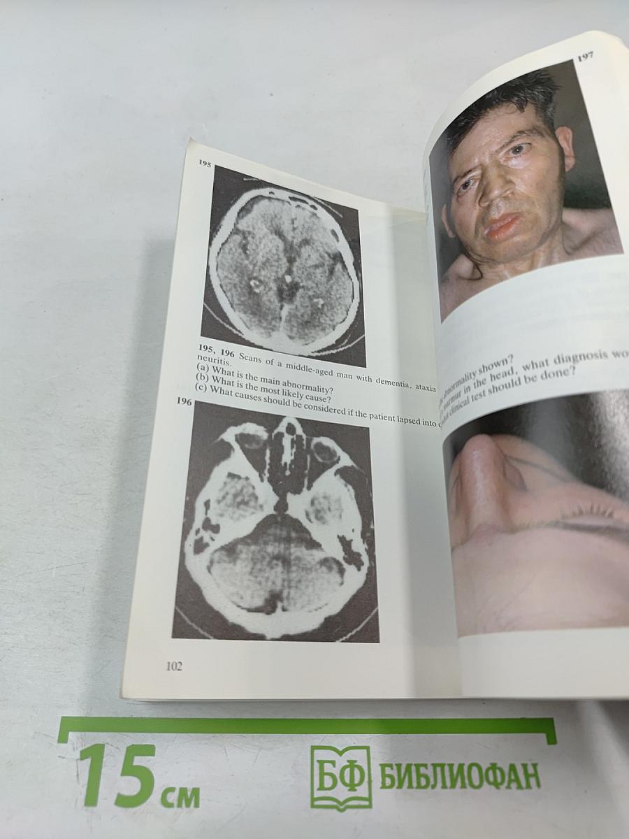 Diagnostic Picture Tests in Clinical Neurology