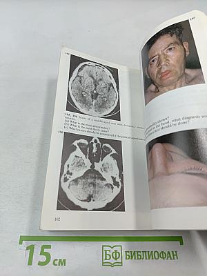 Diagnostic Picture Tests in Clinical Neurology