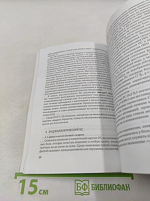 Рассеянный склероз: диагностика, лечение, специалисты