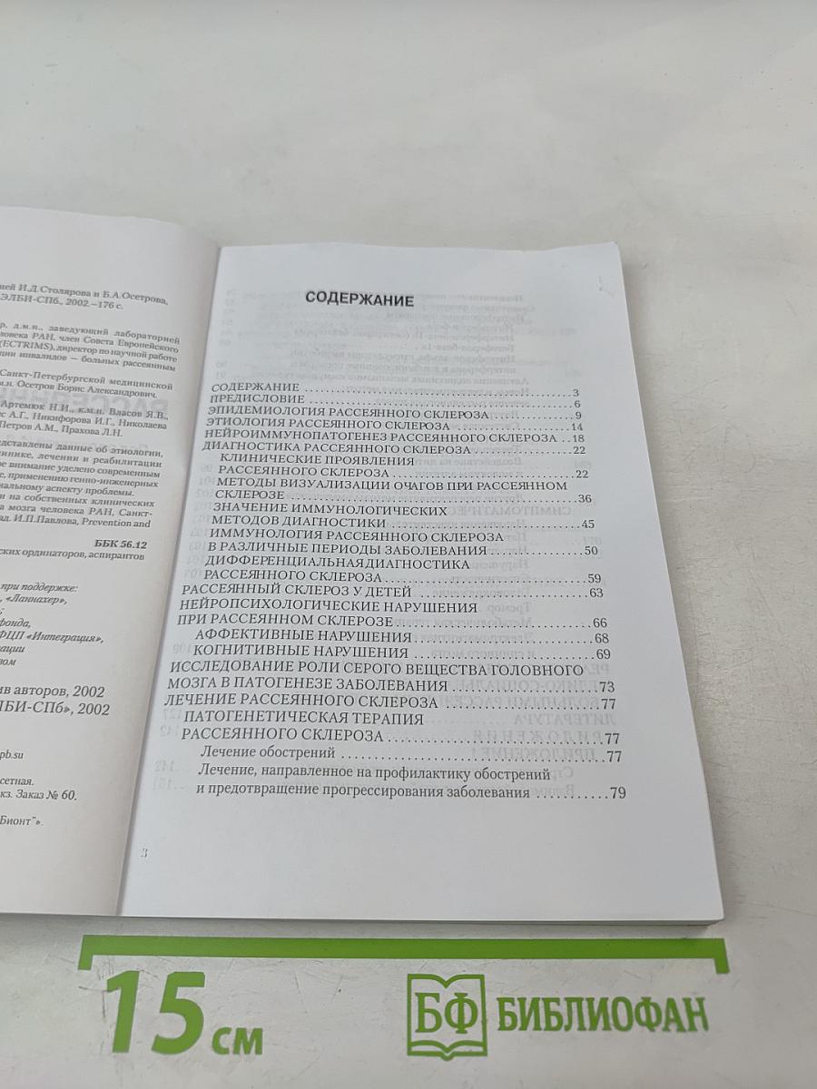 Рассеянный склероз