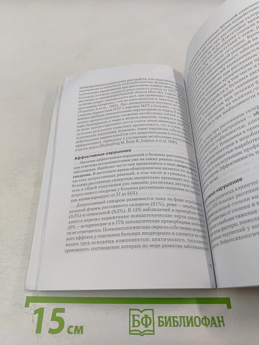 Рассеянный склероз