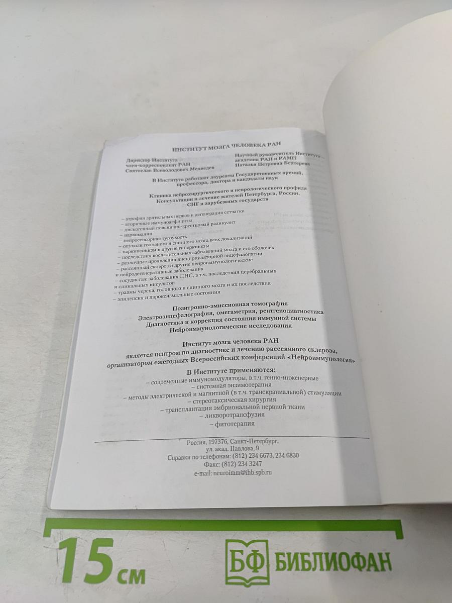 Рассеянный склероз