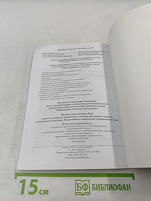 Рассеянный склероз