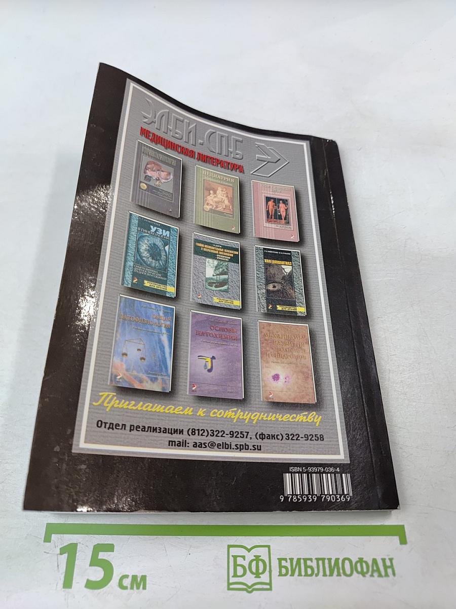 Рассеянный склероз