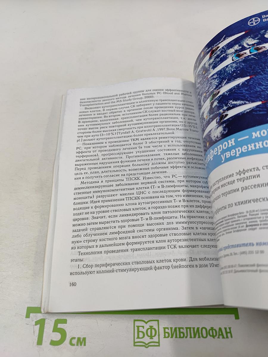 Рассеянный склероз: диагностика, лечение, специалисты