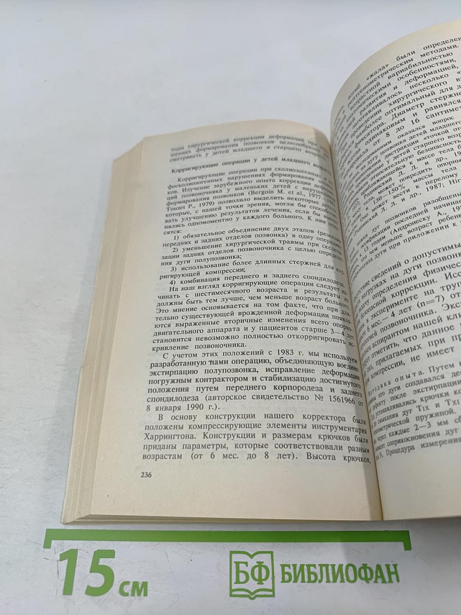 Аномалии позвоночника у детей