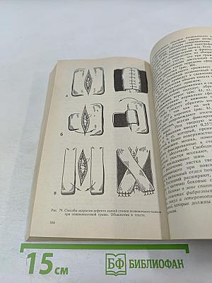 Аномалии позвоночника у детей