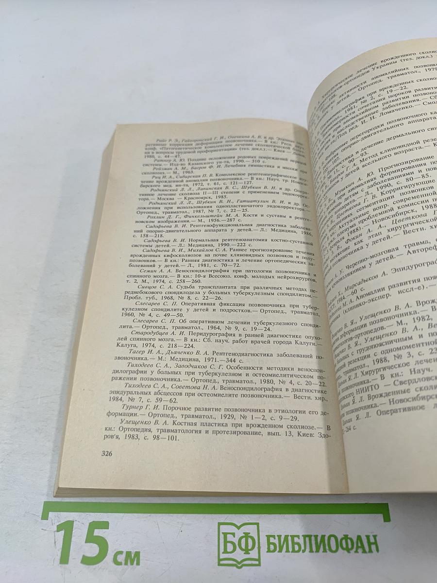 Аномалии позвоночника у детей