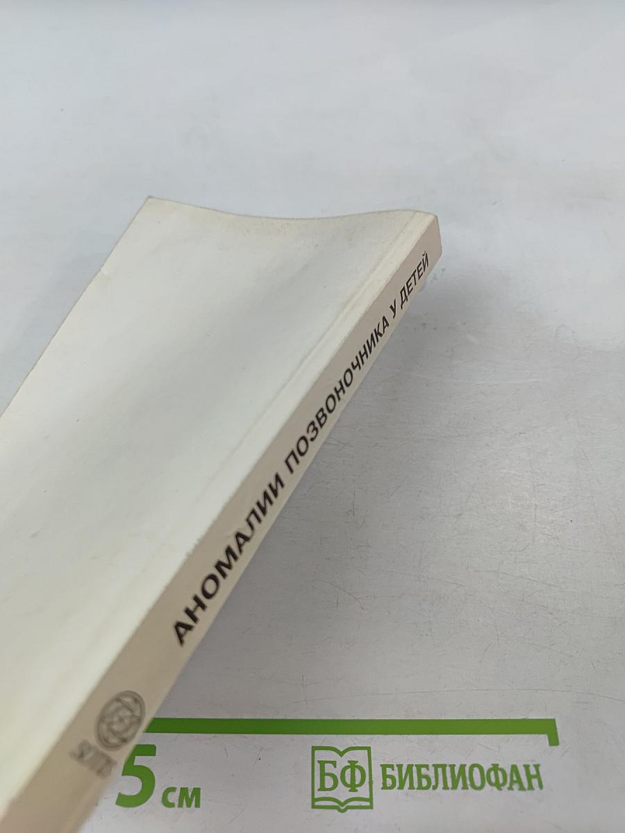 Аномалии позвоночника у детей