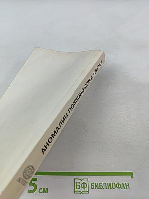 Аномалии позвоночника у детей