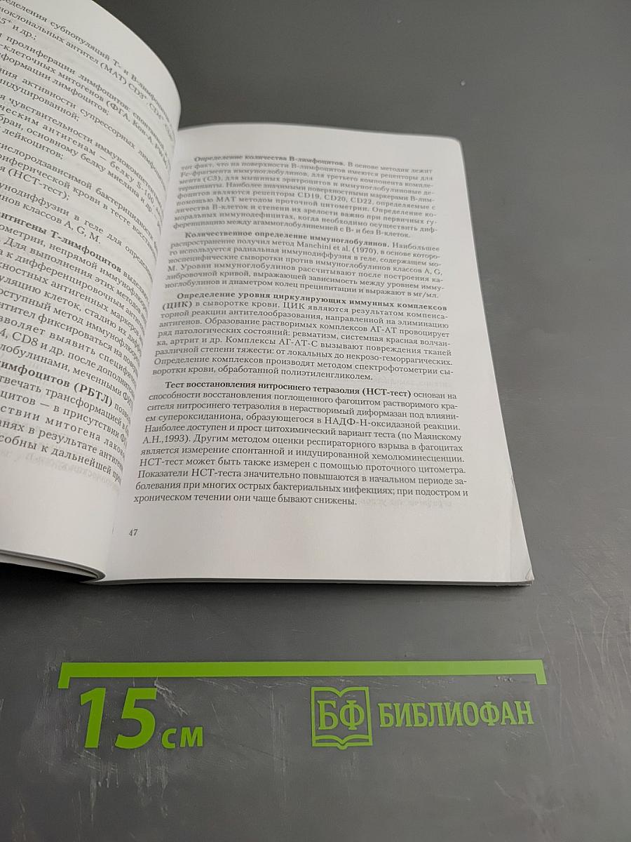 Рассеянный склероз