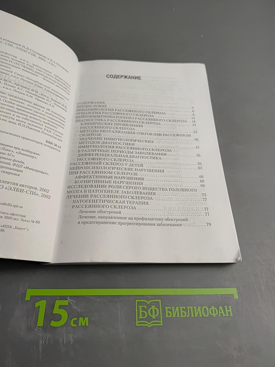 Рассеянный склероз