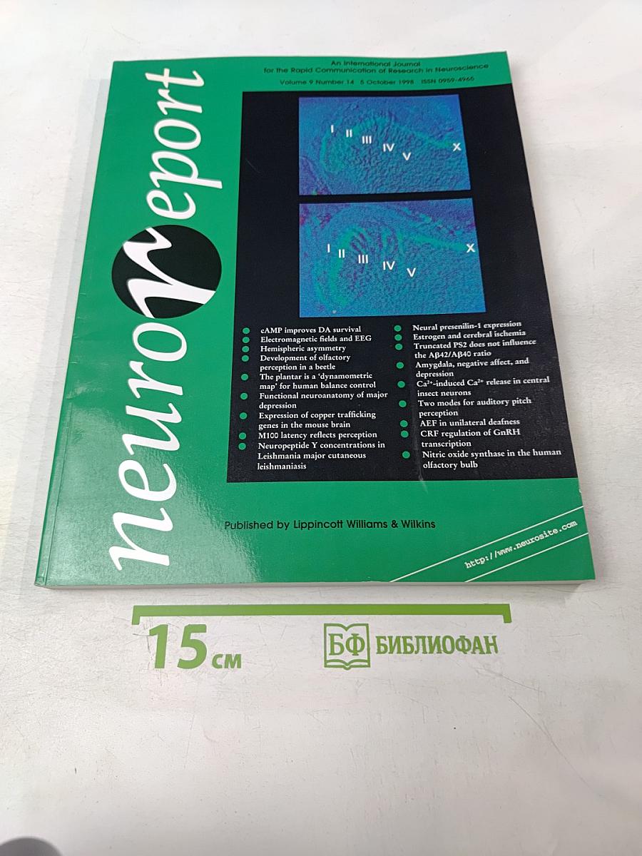 NeuroReport: An International Journal for the Rapid Communication of Research in Neuroscience, Volume 9 Number 14