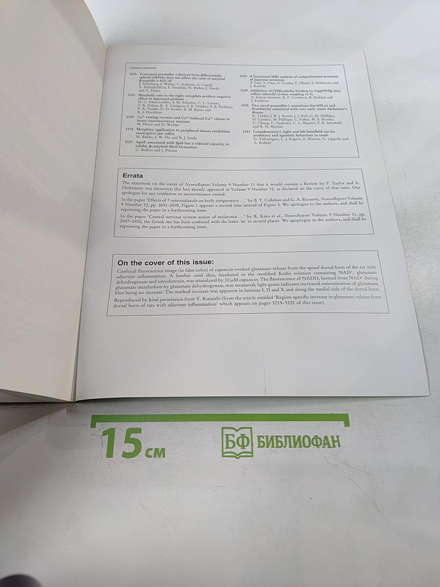 NeuroReport: An International Journal for the Rapid Communication of Research in Neuroscience, Volume 9 Number 14