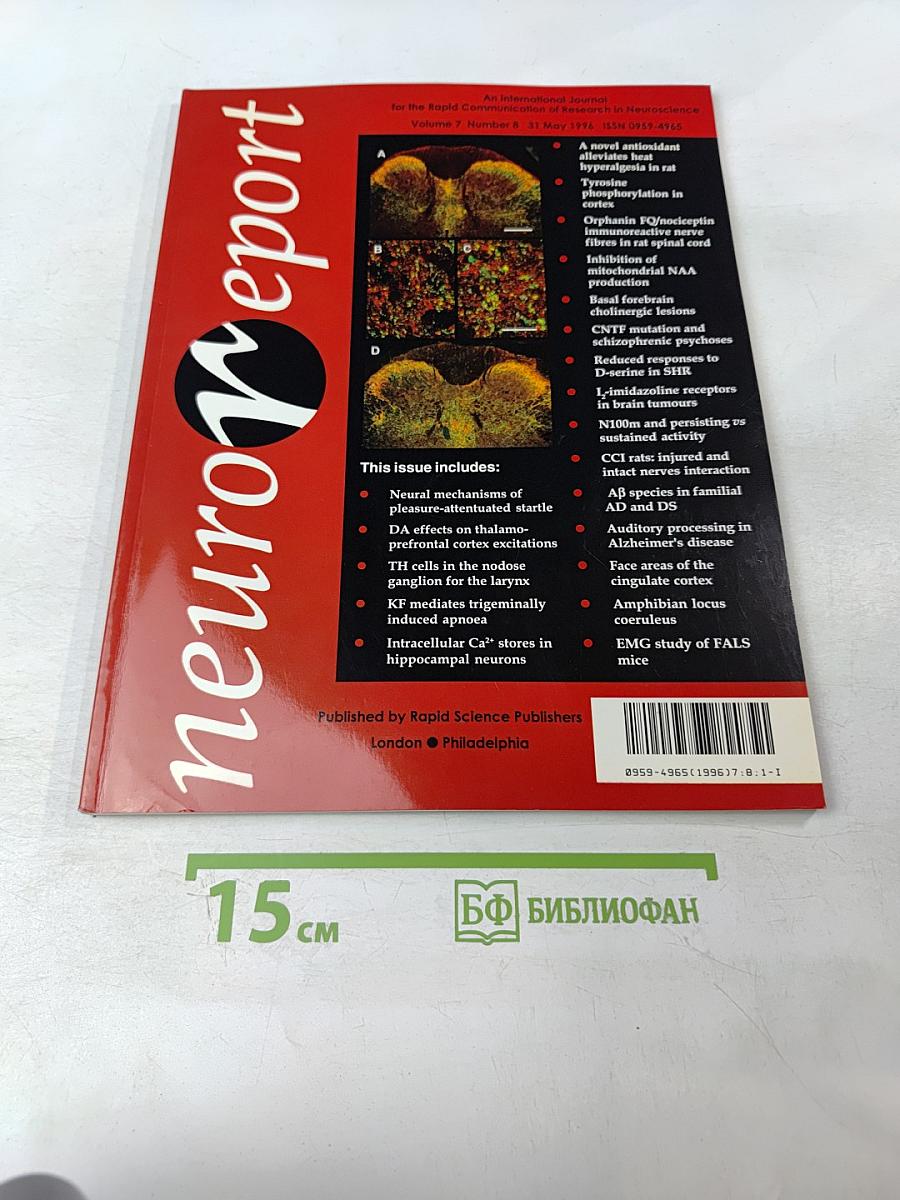 NeuroReport, Volume 7, Number 8