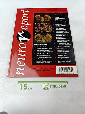 NeuroReport, Volume 7, Number 8