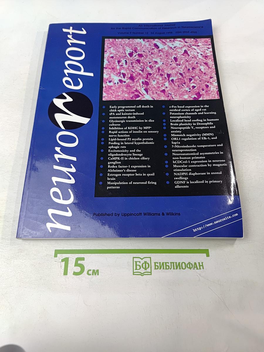 NeuroReport: An International Journal for the Rapid Communication of Research in Neuroscience, Volume 9, Number 12