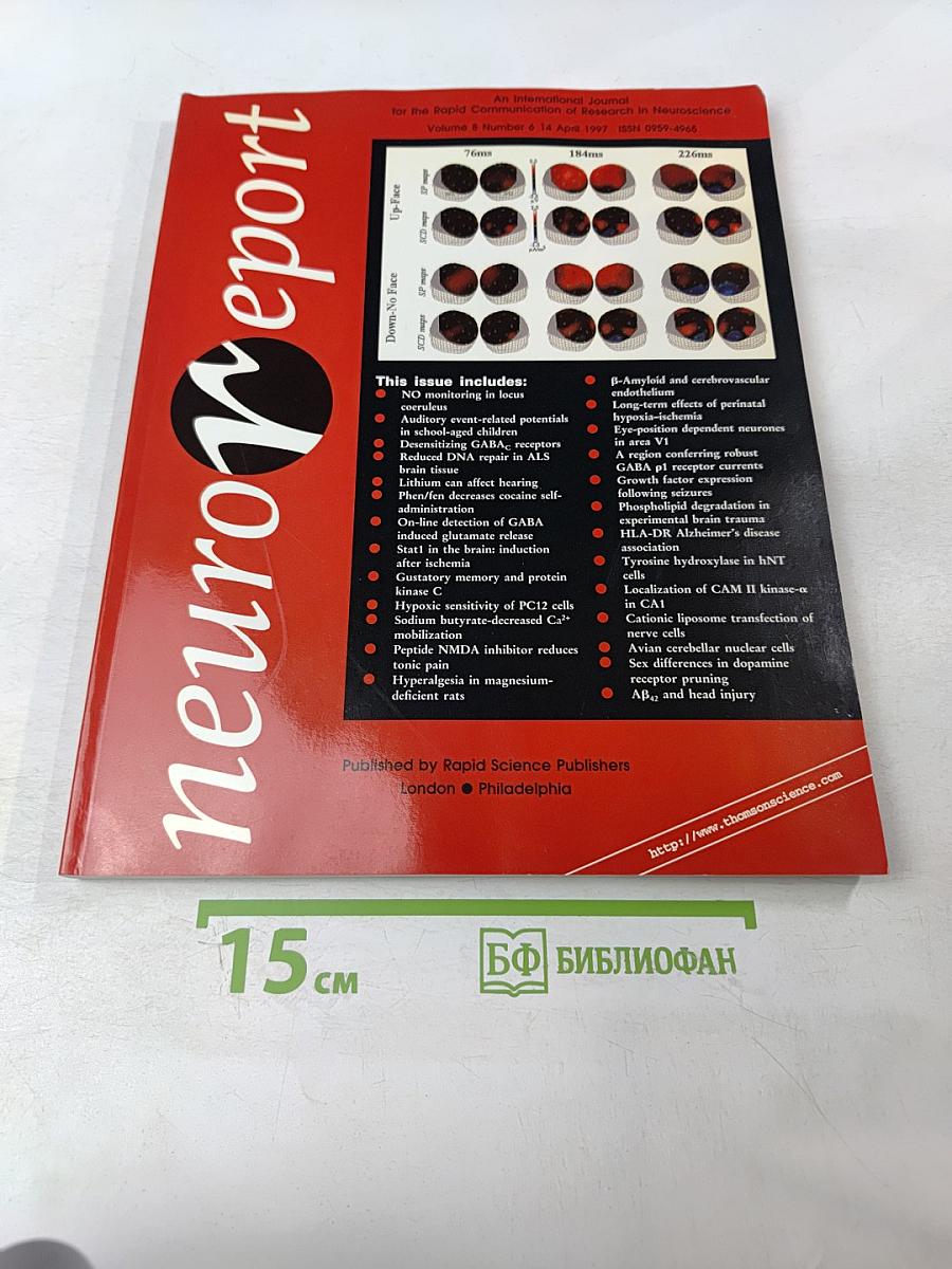 Neuroreport. An International Journal for the Rapid Communication of Research in Neuroscience. Volume 8, Number 6. 14 April 1997. pp 1321-1548