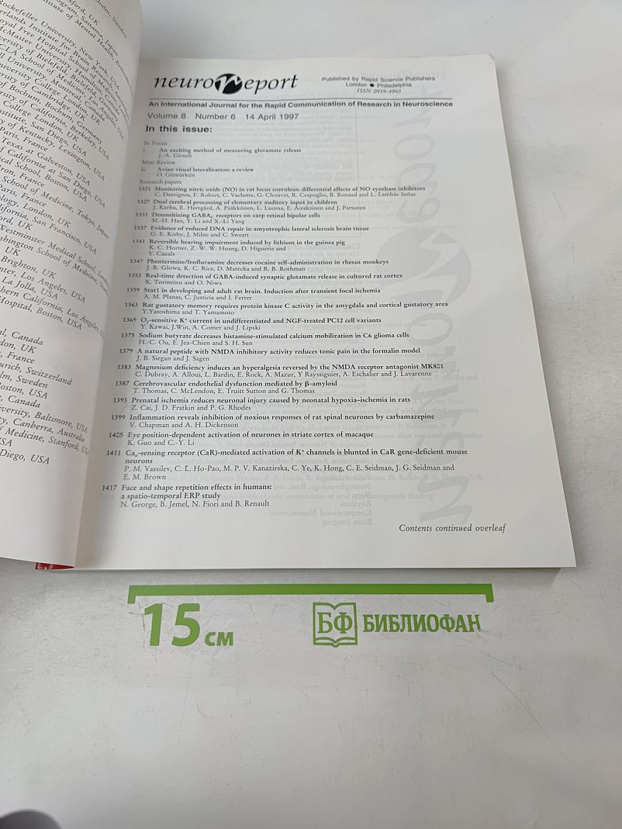 Neuroreport. An International Journal for the Rapid Communication of Research in Neuroscience. Volume 8, Number 6. 14 April 1997. pp 1321-1548