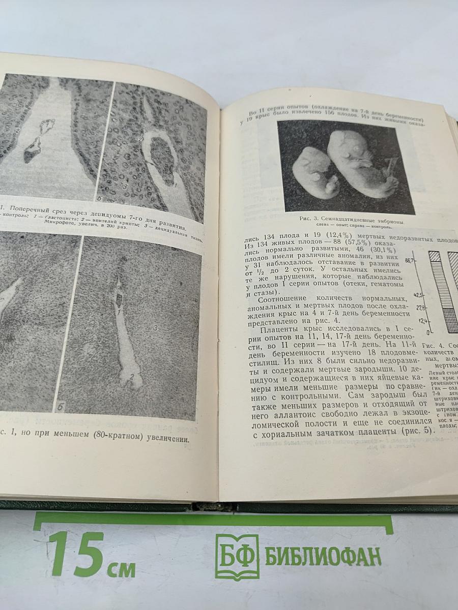 Патофизиология внутриутробного развития