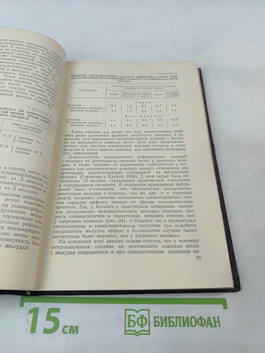 Кортико-висцеральная теория патогенеза язвенной болезни