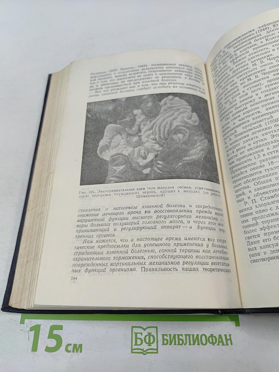 Кортико-висцеральная теория патогенеза язвенной болезни