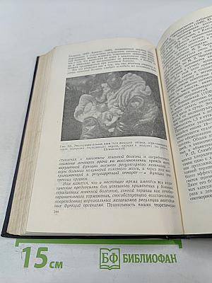 Кортико-висцеральная теория патогенеза язвенной болезни