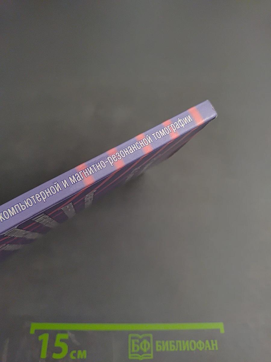 Физико-технические основы рентгенологии, компьютерной и магнитно-резонансной томографии. Фотопроцесс и информационные технологии в лучевой диагностике