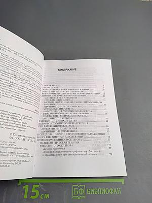 Рассеянный склероз