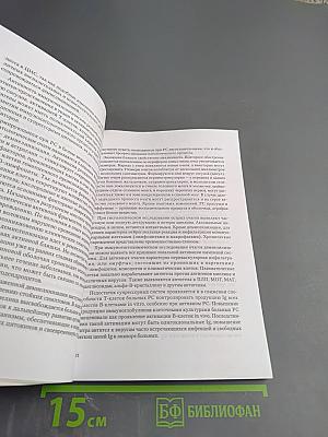 Рассеянный склероз