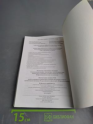 Рассеянный склероз