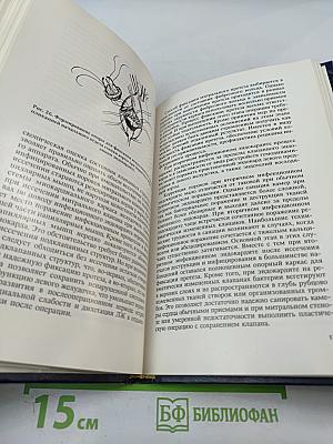 Хирургическое лечение инфекционного эндокардита