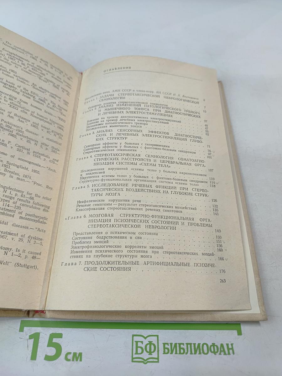 Стереотаксическая неврология