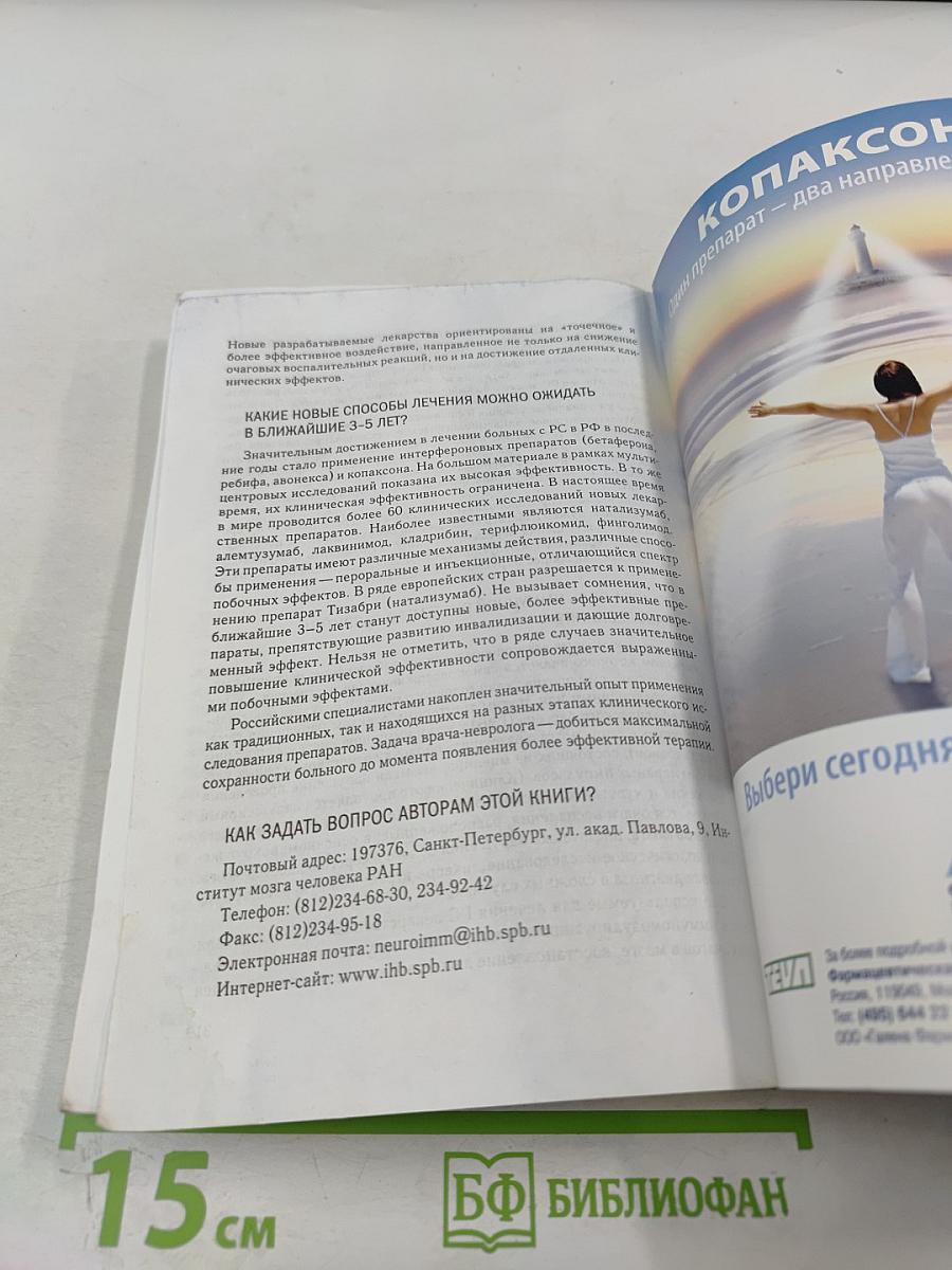 Рассеянный склероз: диагностика, лечение, специалисты