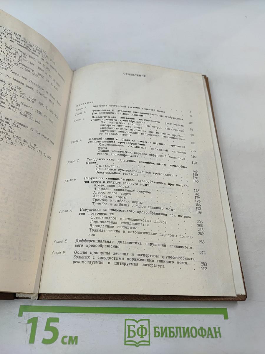 Нарушения спинномозгового кровообращения