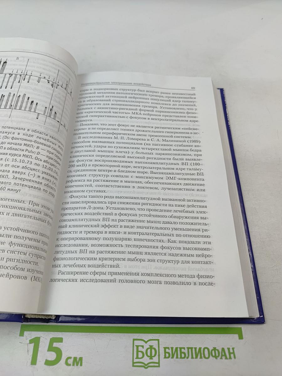 Лечебная электрическая стимуляция мозга и нервов человека