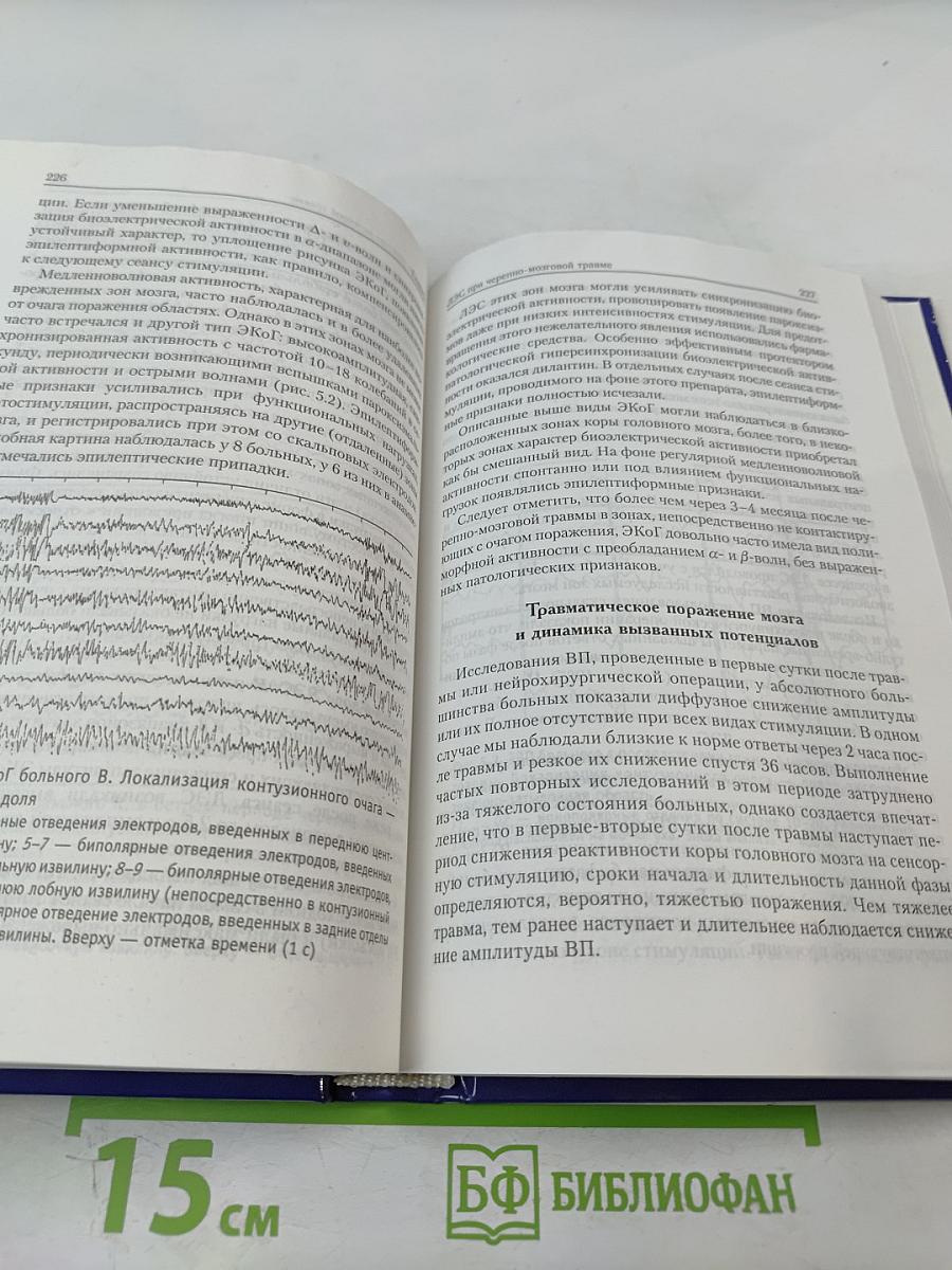 Лечебная электрическая стимуляция мозга и нервов человека