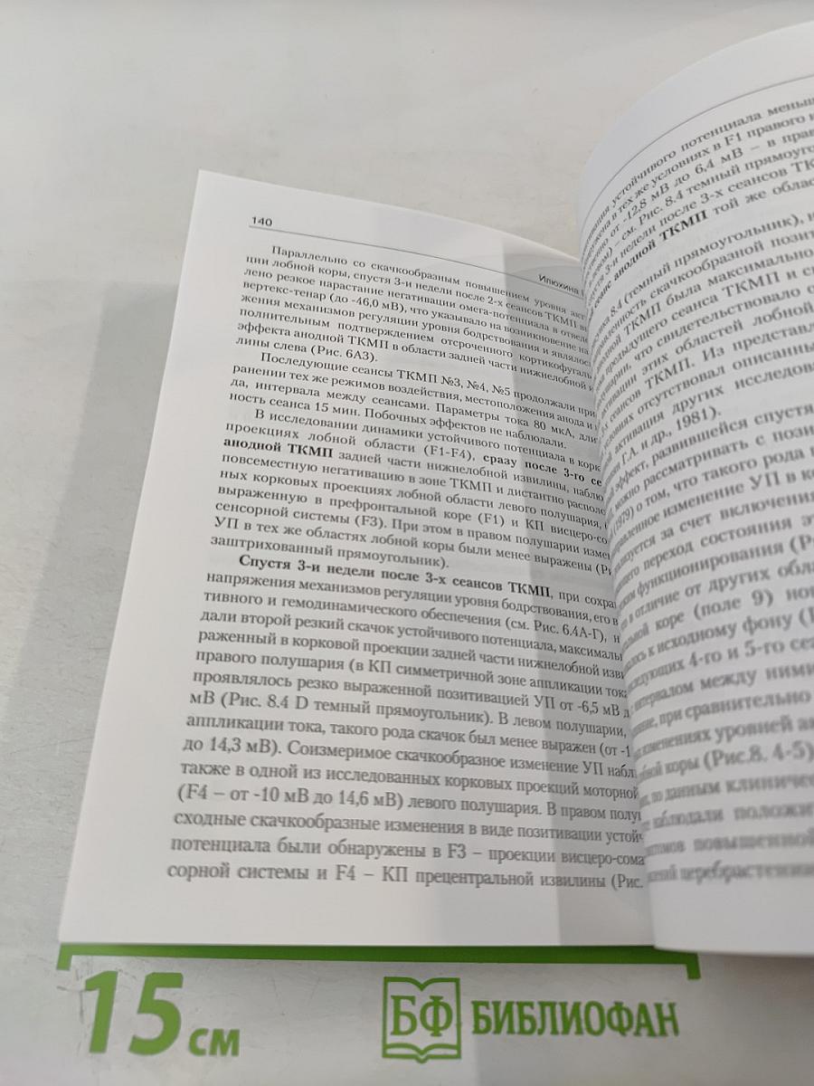 Транскраниальная микрополяризация в физиологии и клинике