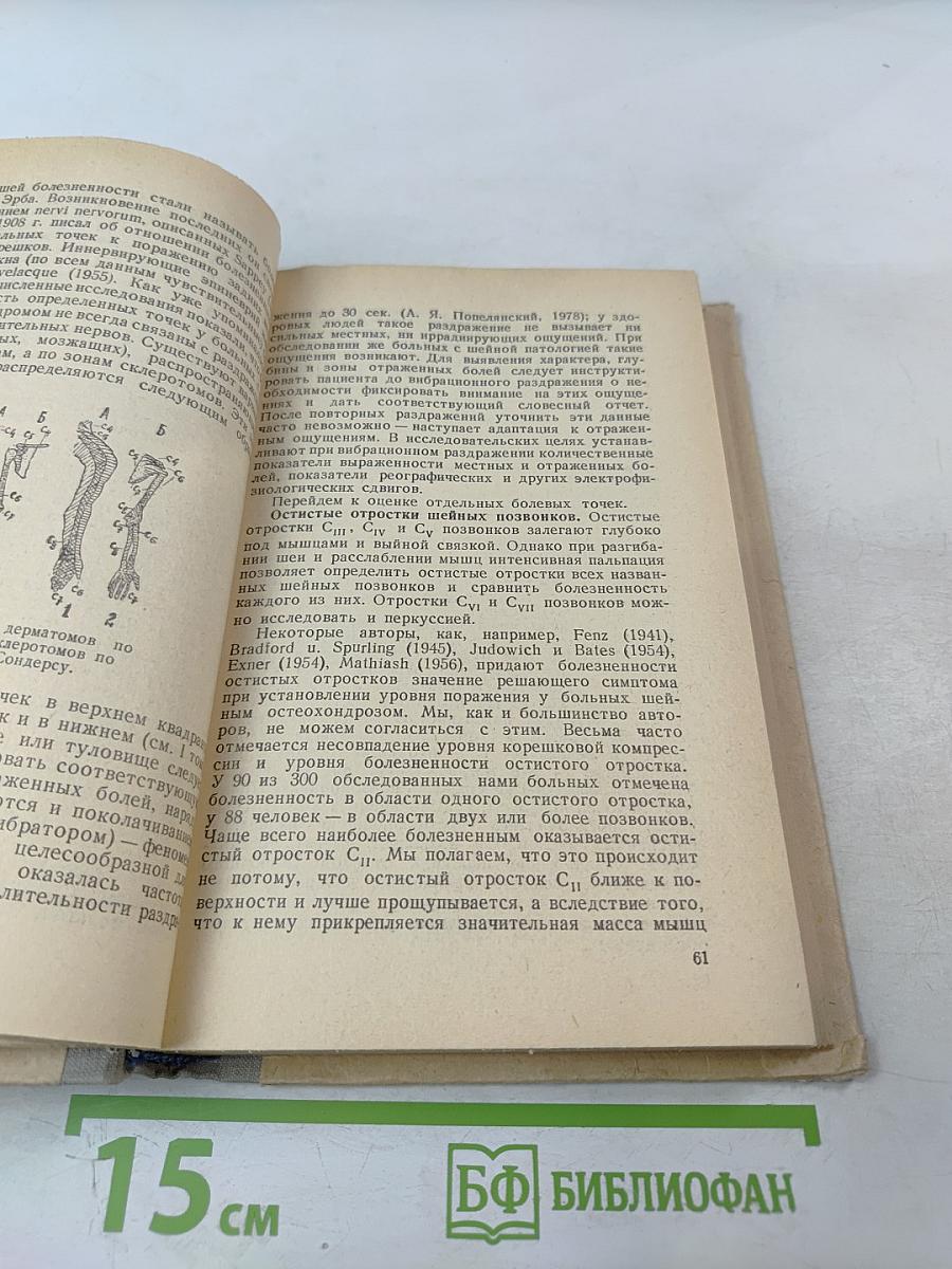 Вертеброгенные заболевания нервной системы