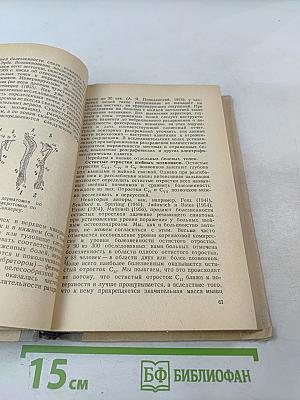 Вертеброгенные заболевания нервной системы