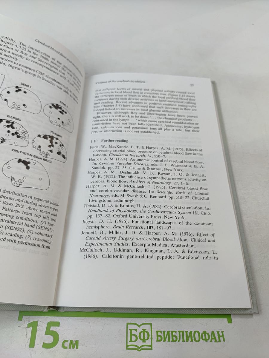 Cerebral blood flow and metabolism