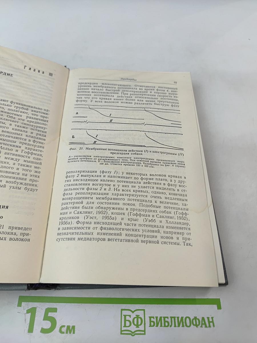 Электрофизиология сердца