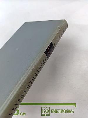 Электрофизиология сердца