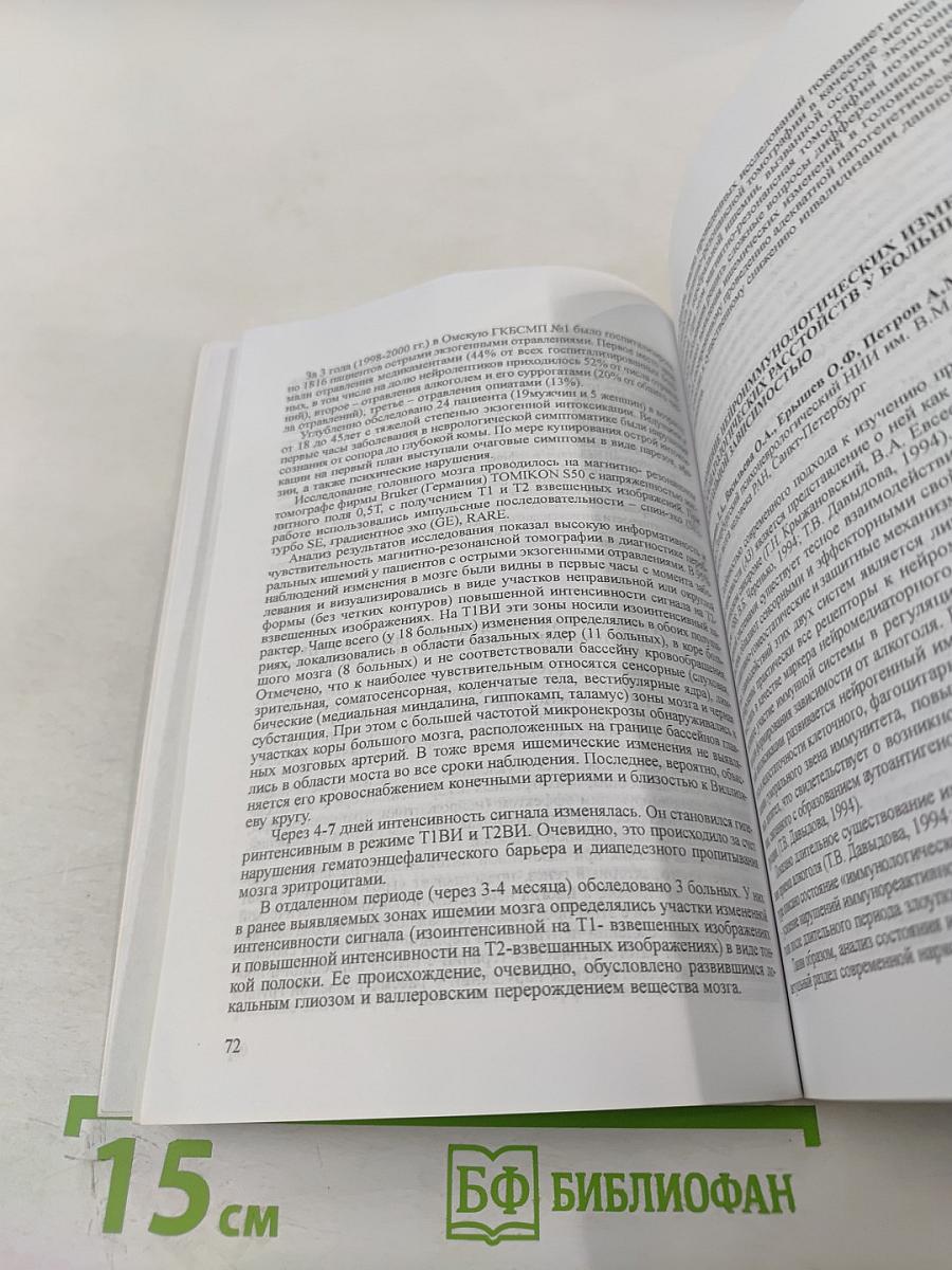 Неврология - Иммунология