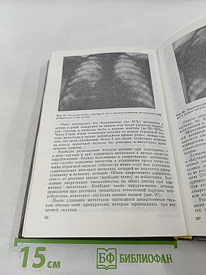 Болезни органов дыхания у детей