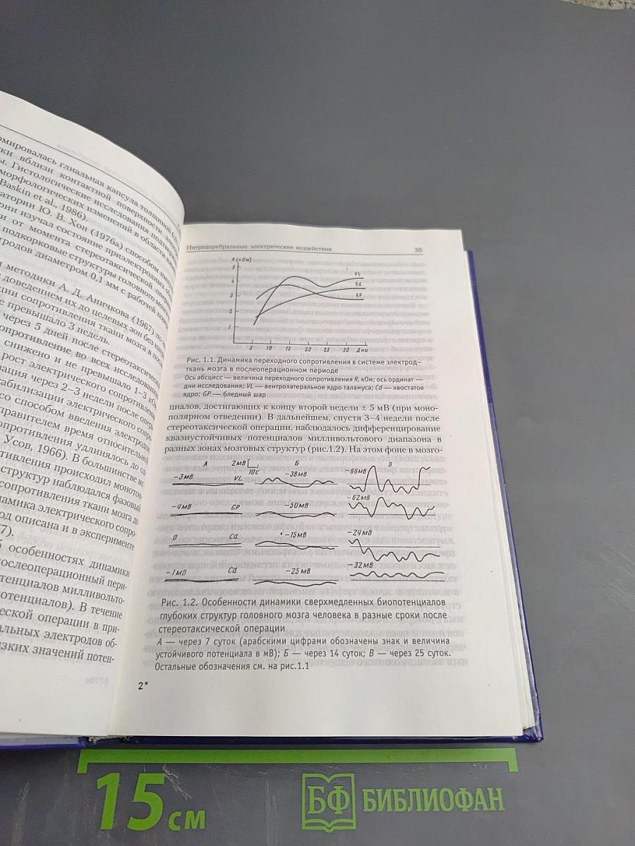 Лечебная электрическая стимуляция мозга и нервов человека