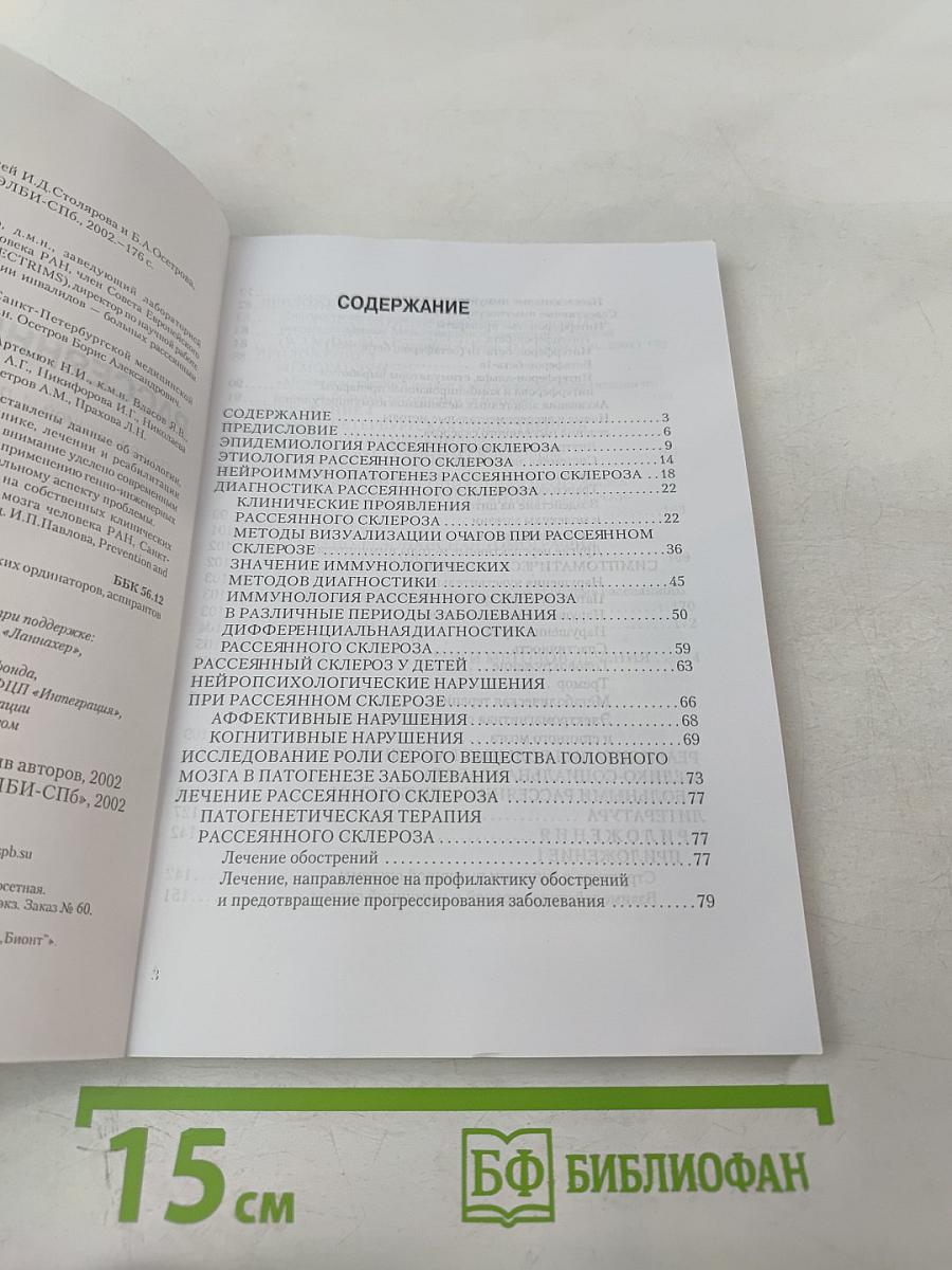 Рассеянный склероз